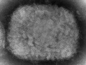 欧美至少8国发现猴痘确诊 疑似病例：感染源未确认