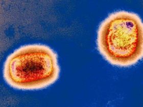 多国出现猴痘病例，会成为另一个大规模传染病吗